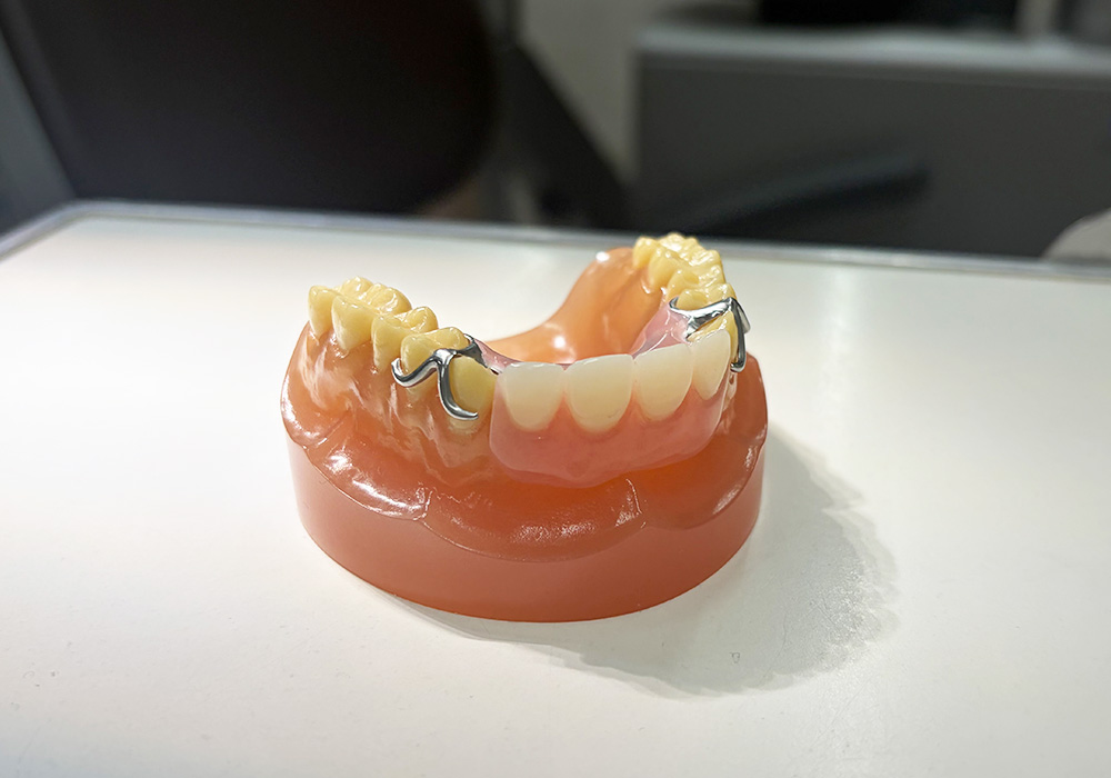 入れ歯の写真